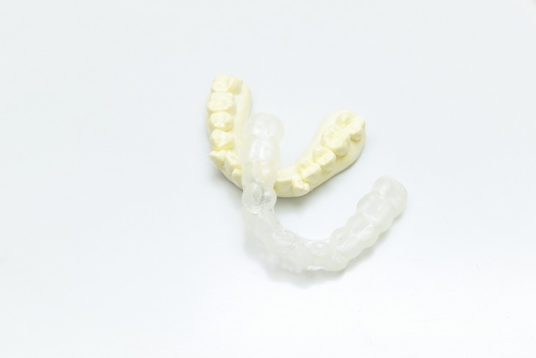 歯ぎしりの治療