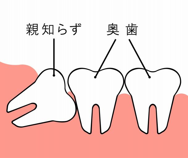 嗚咽 歯磨き